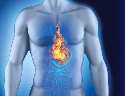 Acid flux effects on Human body